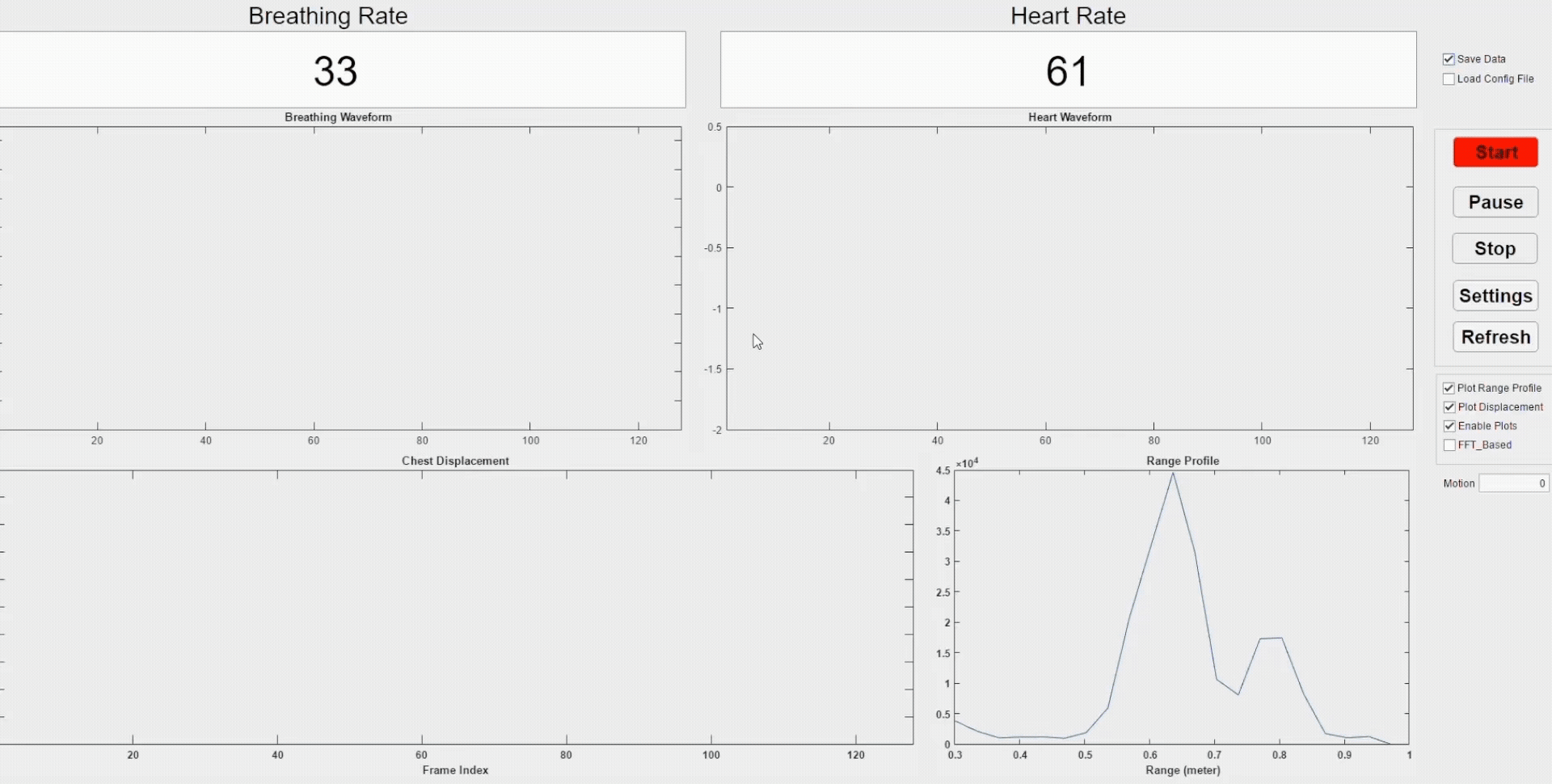 Live radar dashboard reading a breathing rate of 33 and a heart rate of 61, with breathing and heart waveforms, chest displacement and a range profile